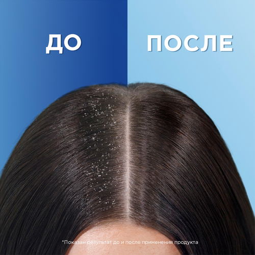 Шампунь-бальзам против перхоти HEAD&SHOULDERS Основной уход 2в1, 600мл, фото
